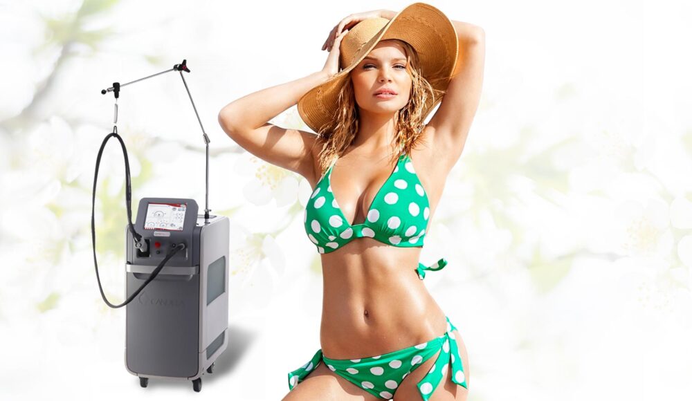 Laser Hair Removal by Candela GentleMax Pro